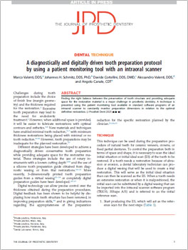 A diagnostically and digitally driven tooth preparation protocol by using a patient monitoring tool with an intraoral scanner